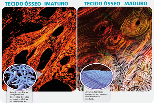 Histologia óssea para perioimplantodontistas – parte 2