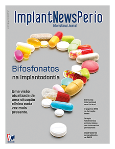 Revista ImplantNewsPerio v3n3