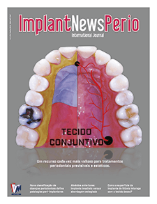 Revista ImplantNewsPerio v3n5